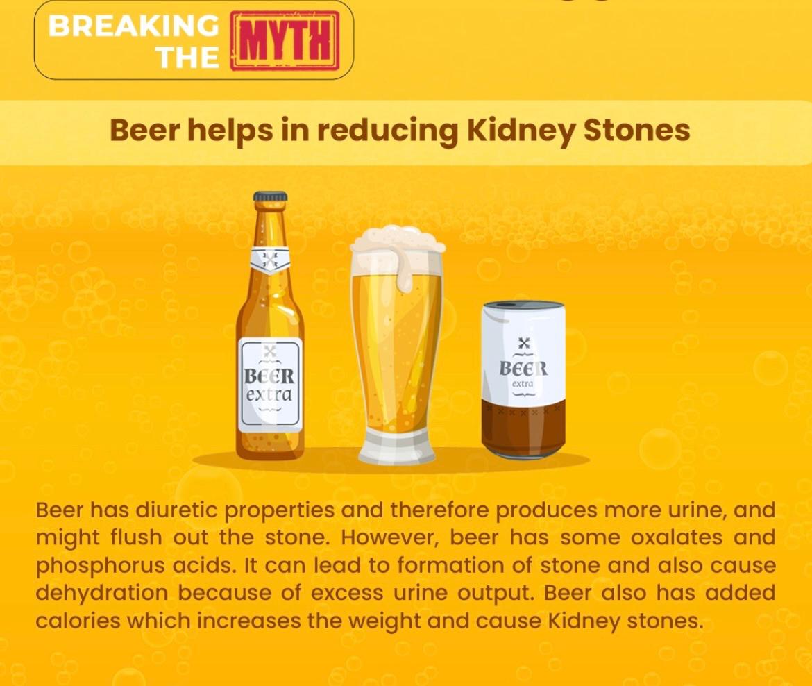 Breaking the myth: Beer and kidney stones