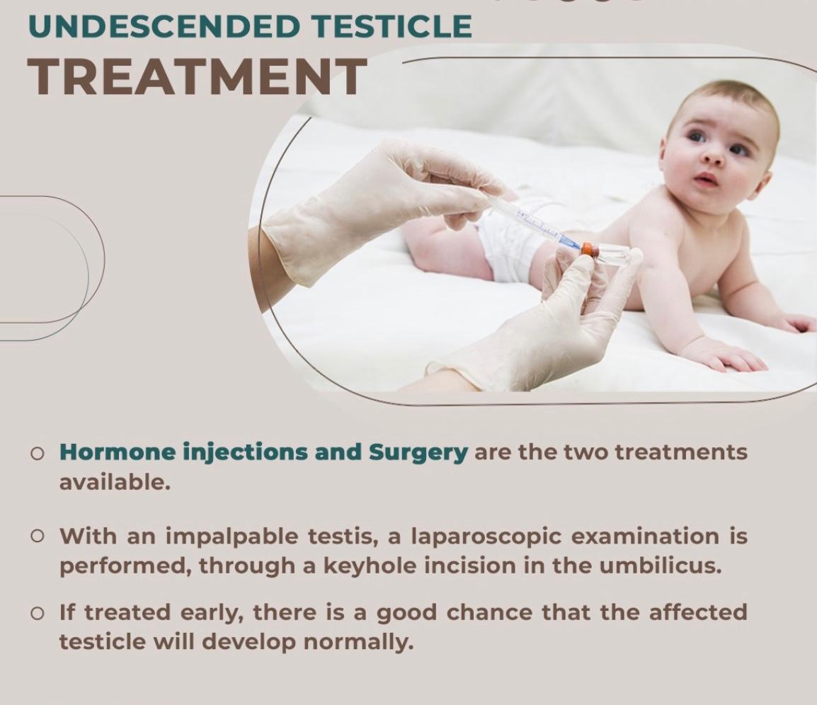 Undescended testicle treatment options